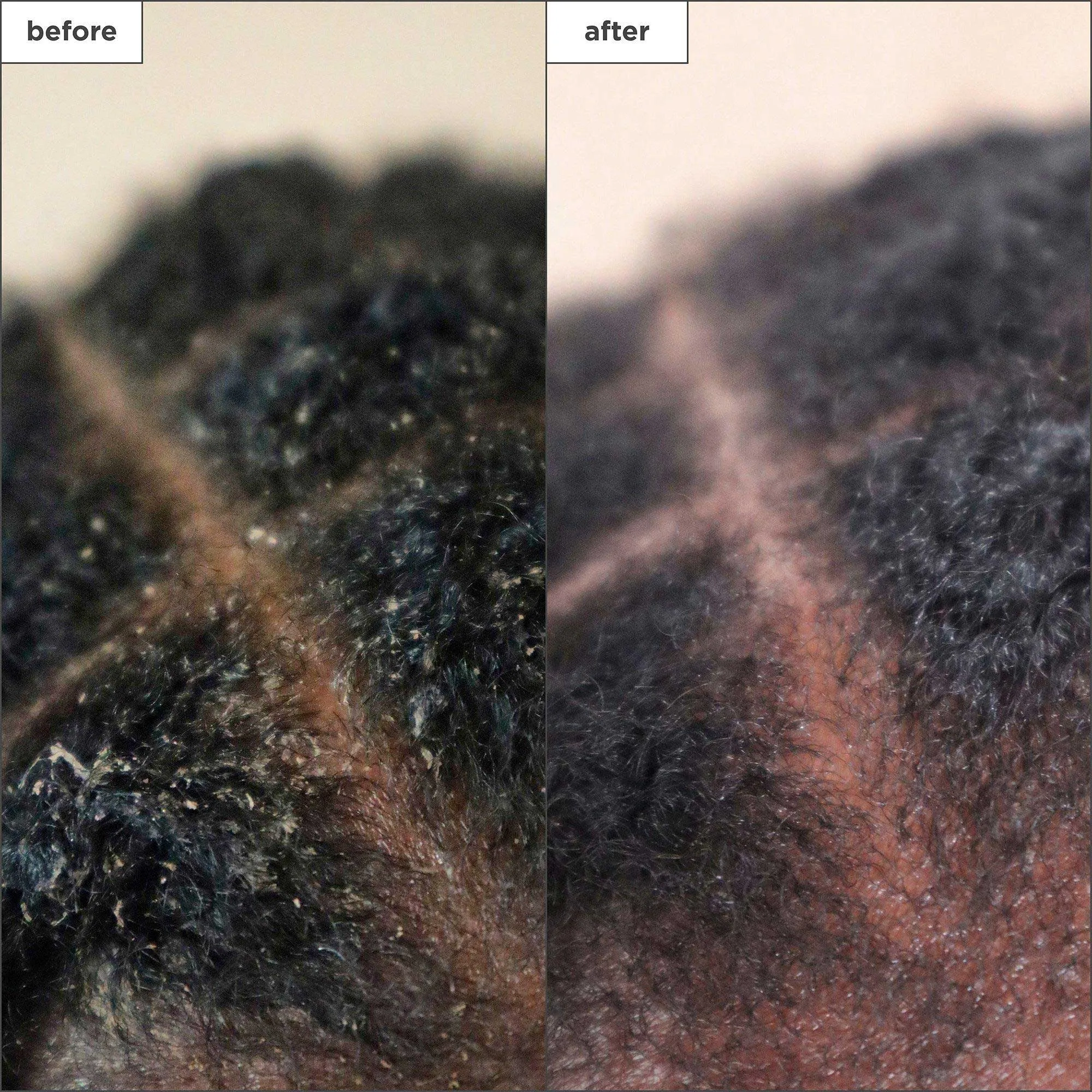 Briogeo Scalp Revival Charcoal   Tea Tree Scalp Treatment Serum