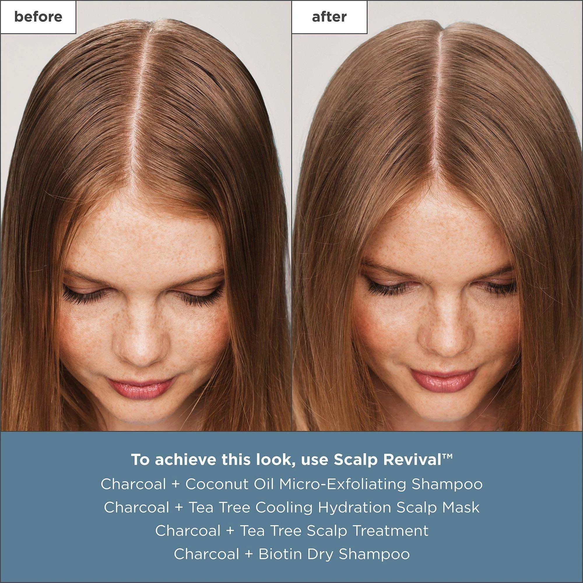 Briogeo Scalp Revival Charcoal   Tea Tree Scalp Treatment Serum