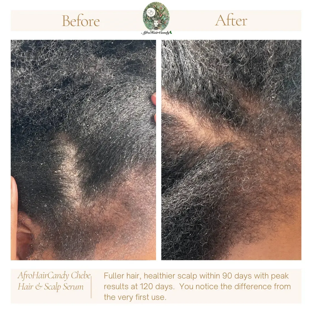 Chebe Hair and Scalp Serum