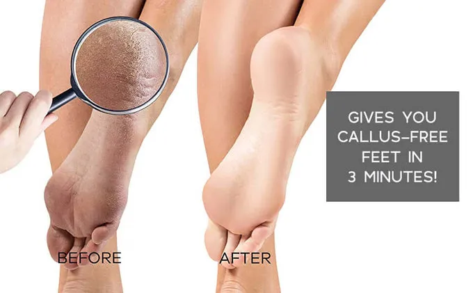 Dermasuri Deep Exfoliate Polish & Glow Foot Scrub Set